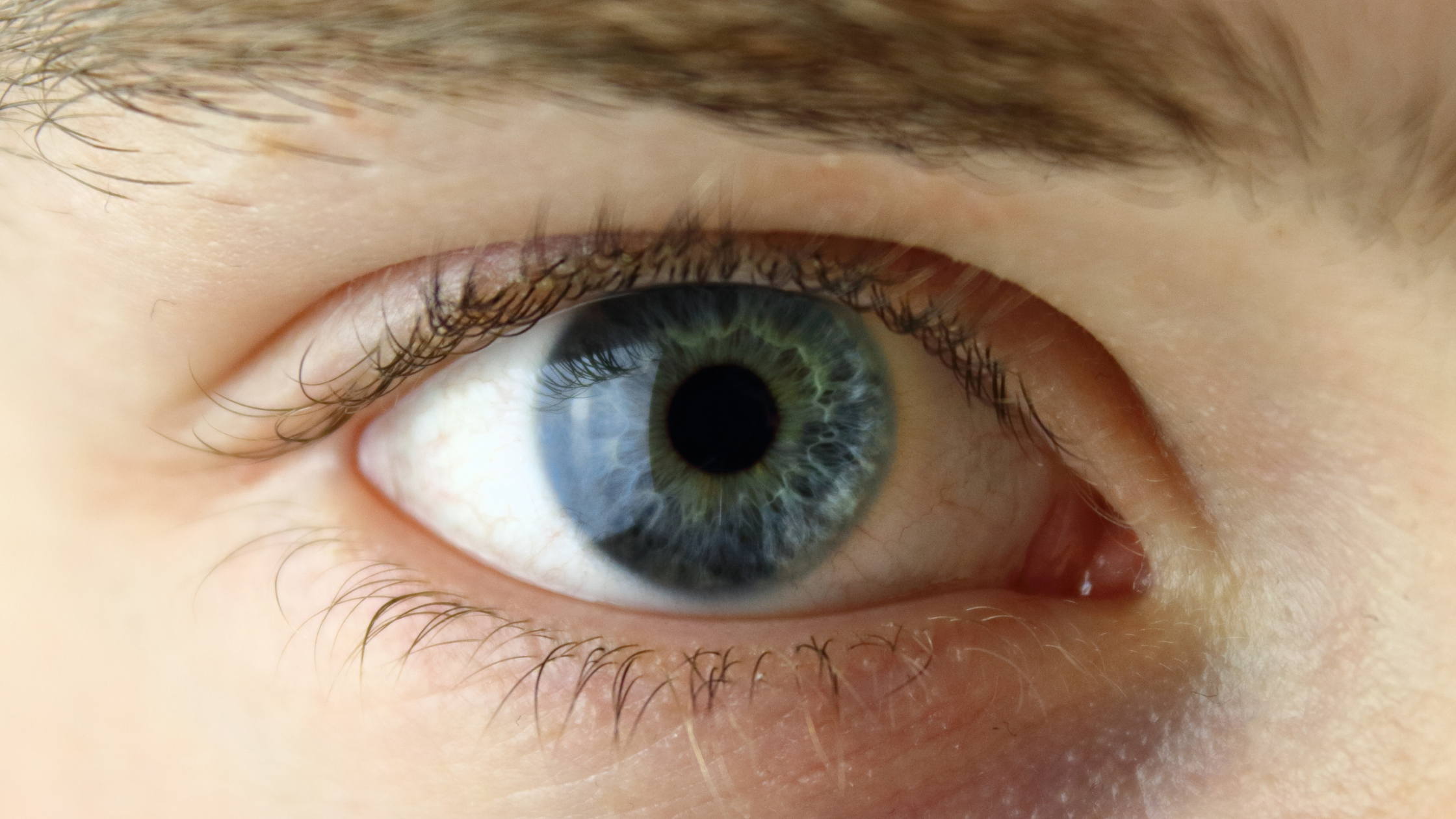 Plástica ocular
